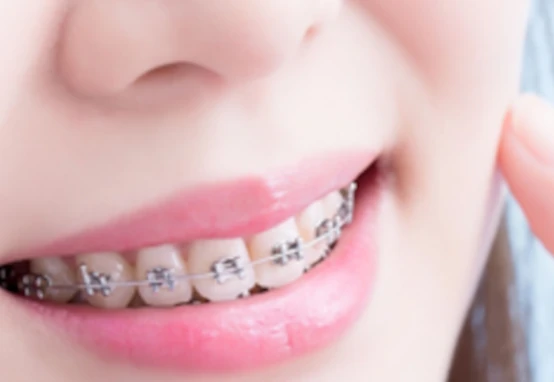 ทันตกรรมเด็ก