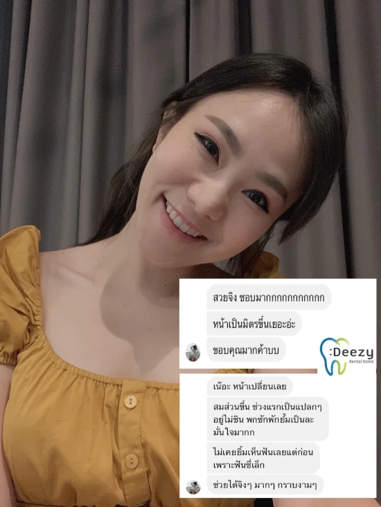 จัดฟันขอนแก่น, จัดฟันอุดรธานี, จัดฟันอุบลราชธานี รีวิว 13