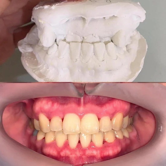 จัดฟันขอนแก่น, จัดฟันอุดรธานี, จัดฟันอุบลราชธานี  รีวิว 5