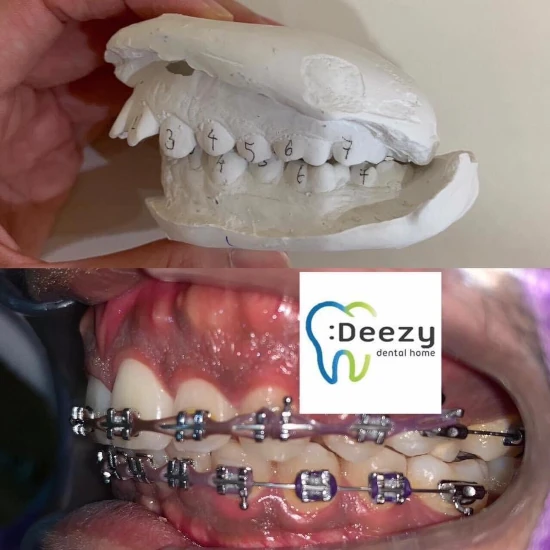 จัดฟันขอนแก่น, จัดฟันอุดรธานี, จัดฟันอุบลราชธานี  รีวิว 7