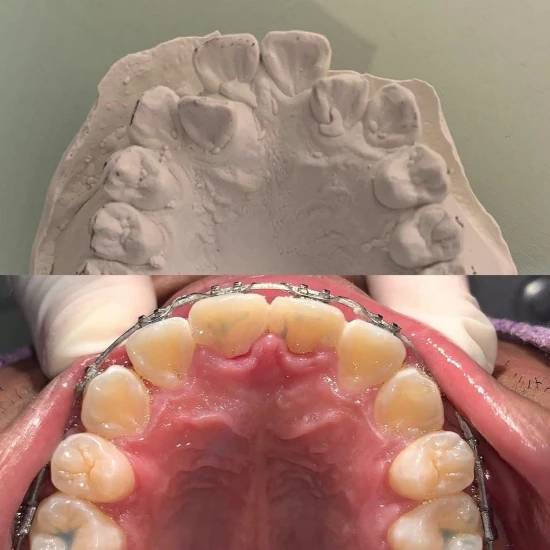 จัดฟันขอนแก่น, จัดฟันอุดรธานี, จัดฟันอุบลราชธานี  รีวิว 8