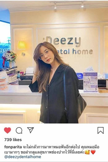 รีวิววีเนียร์แปะฟันขาว