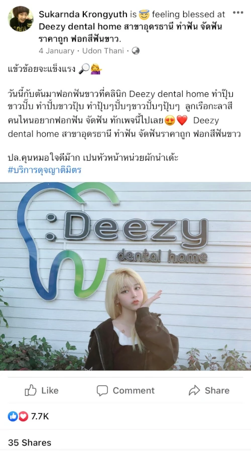 รีวิววีเนียร์แปะฟันขาว