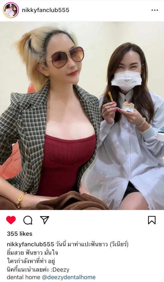 รีวิววีเนียร์แปะฟันขาว