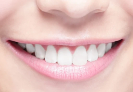 ค่าบริการ - ทันตกรรมเพื่อความงาม อุดรธานี อุบลราชธานี ขอนแก่น