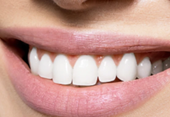 ค่าบริการ - จัดฟัน อุดรธานี อุบลราชธานี ขอนแก่น