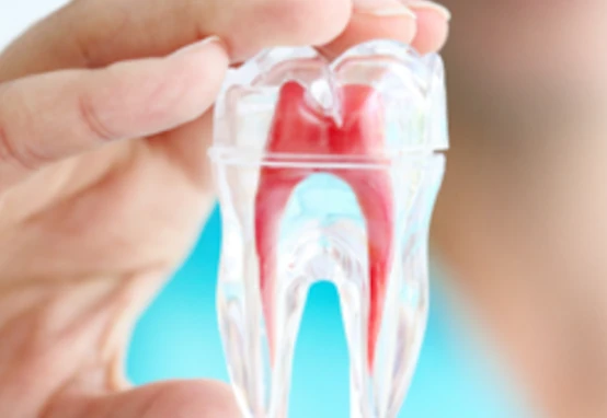 ค่าบริการรักษารากฟัน - จัดฟัน อุดรธานี อุบลราชธานี ขอนแก่น